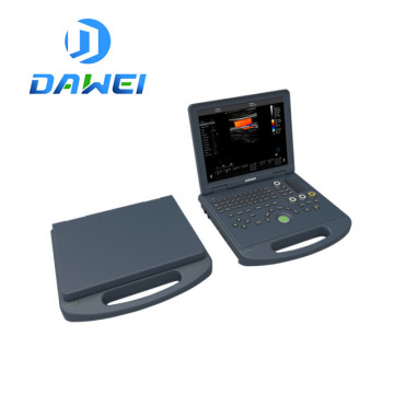 Escáner de ultrasonido doppler portátil y máquina Doppler color 3D